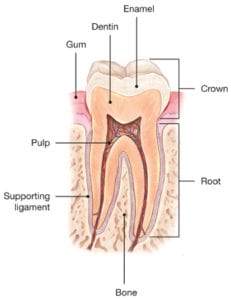 Cracked Tooth Diagram 1